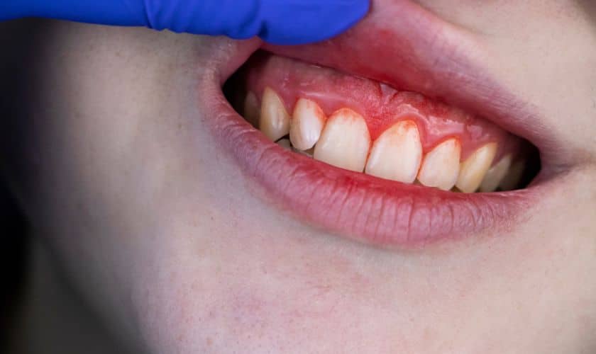Featured image for “Highland Dental Studio Guide: How Oral Cancer Affects Our Body”